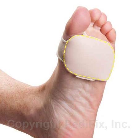 Forefoot Cushions