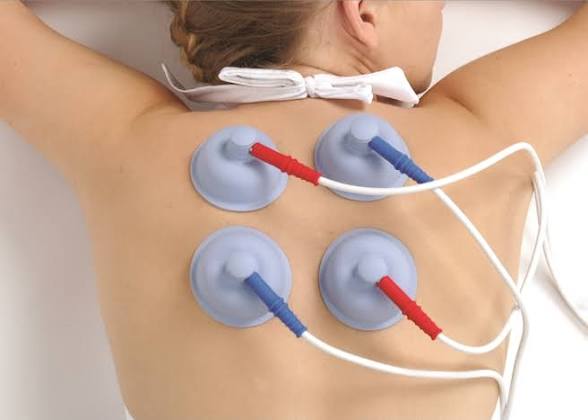 Interferential Stimulators