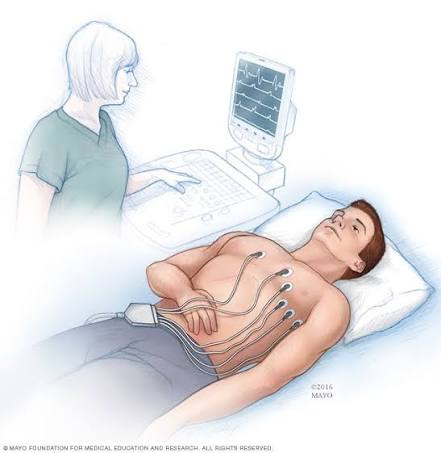 ECG- Eletrocardiograph