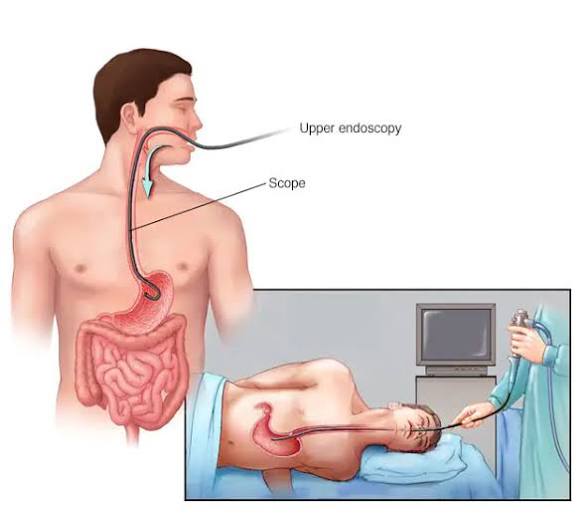 Endoscopy