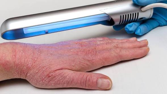 Lamps-UV & Access - Phototherapy