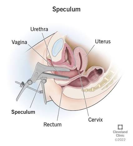 Speculum - Vaginal