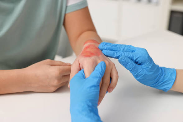 Wound Care